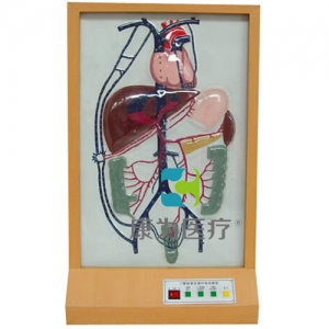 “康為醫療”門靜脈側支循環電動模型