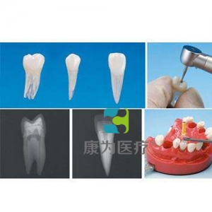 “康為醫療”帶髓腔根管牙體模型