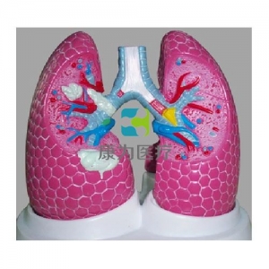 “康為醫療”吸煙者病理肺模型
